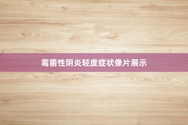 霉菌性阴炎轻度症状像片展示
